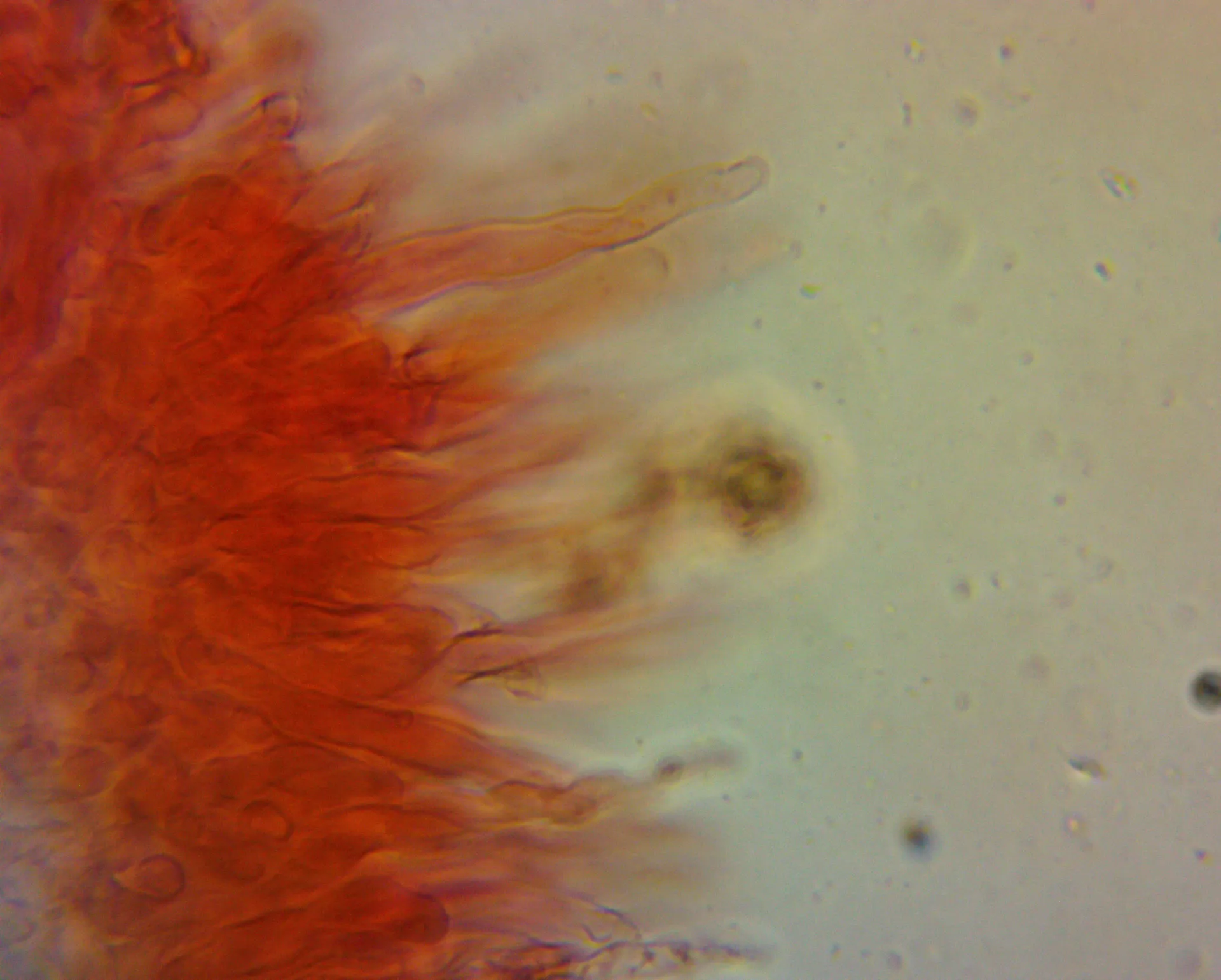 Microscopía de Lactarius acris - Celulas marginales (1)